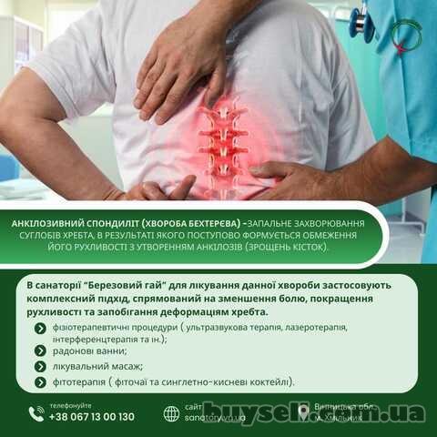 Хвороба Бехтерєва лікування в санаторію "Березовий гай"