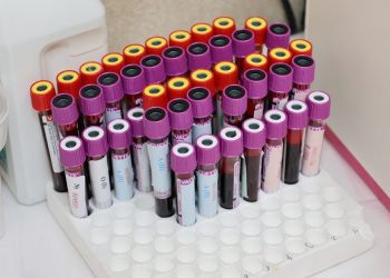 Аналіз 25(OH)D 2027: як розшифрувати результат вітаміну D