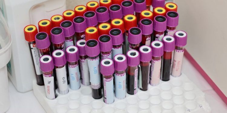 Аналіз 25(OH)D 2027: як розшифрувати результат вітаміну D