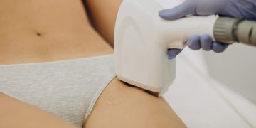 Як підготуватися до лазерної епіляції інтимної зони